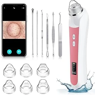 Exclusive Edition Blackhead Remover Vacuum, USB Interface Type Pore Vacuum, Black Head Extractions Tool with Camerafor, Men and Women Pore Cleaner, 3 Adjustment Modes & 6 Suction Heads(Light Pink) — Best Seller